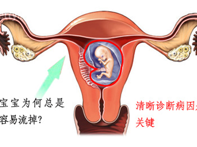 习惯性流产